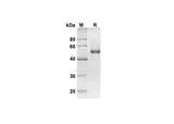 SDS-PAGE analysis of Human CD23 proteins, 2 μg/lane of Recombinant Human CD23 proteins was resolved with SDS-PAGE under reducing conditions, showing bands at 43.8 kDa.