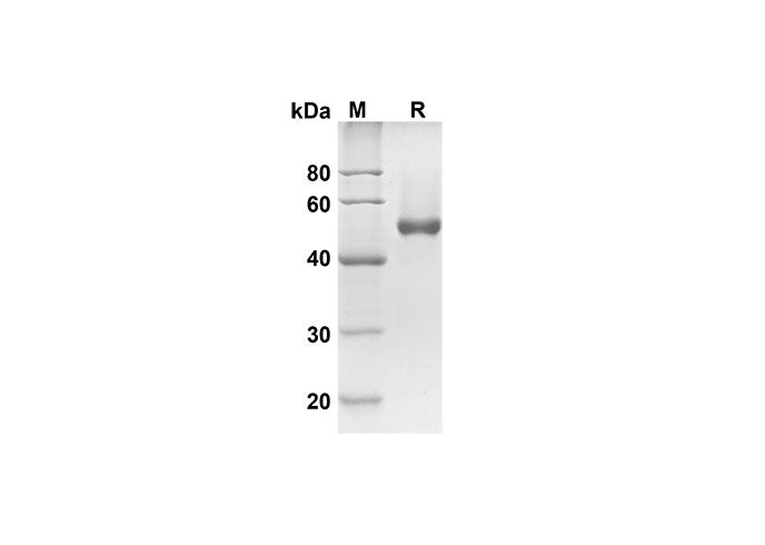 SDS-PAGE analysis of Human CD23 proteins, 2 μg/lane of Recombinant Human CD23 proteins was resolved with SDS-PAGE under reducing conditions, showing bands at 43.8 kDa.