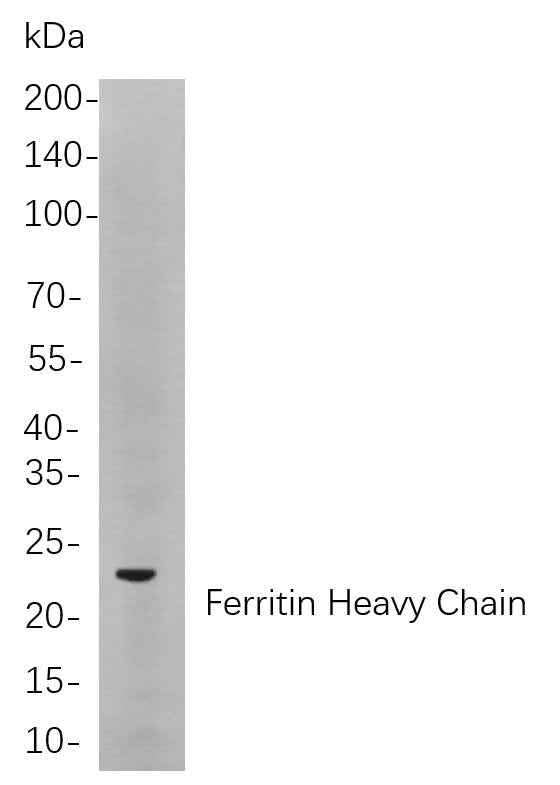 Anti-Human/Mouse/Rat Ferritin heavy chain Antibody [B860] - ABMIUM