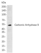 Anti-Human/Mouse/Rat Carbonic Anhydrase 9 Antibody [B808]