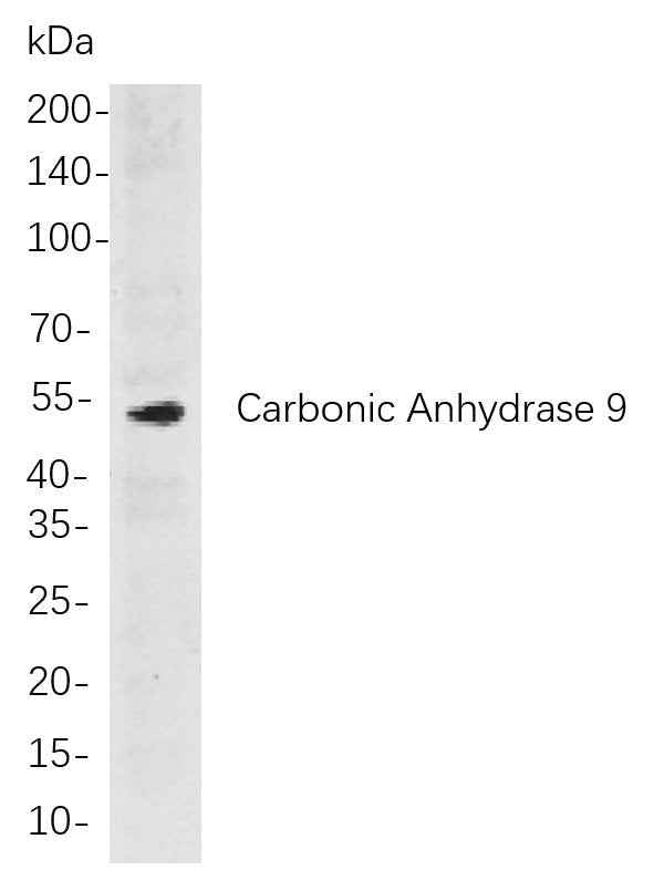 Anti-Human/Mouse/Rat Carbonic Anhydrase 9 Antibody [B808]