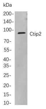 Anti-Human/Mouse/Rat Ctip2 Antibody [B807]