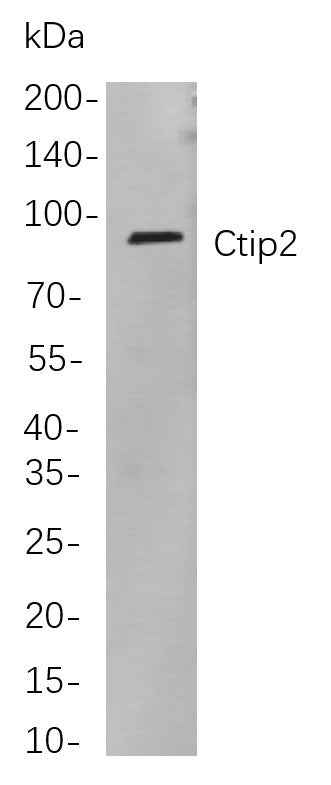 Anti-Human/Mouse/Rat Ctip2 Antibody [B807] - ABMIUM