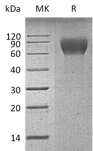 Recombinant Mouse CD6/TP120 Protein (His Tag) - ABMIUM
