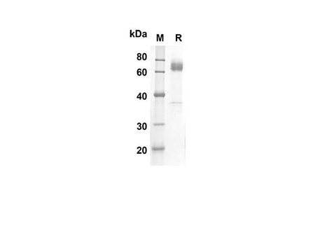 SDS-PAGE analysis of Human IL17RB proteins, 2 μg/lane of Recombinant Human IL17RB proteins was resolved with SDS-PAGE under reducing conditions, showing bands at 55.1 kDa.