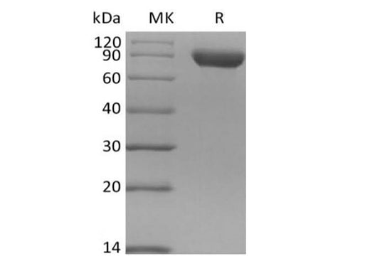 Recombinant Human Siglec-8 (C-Fc) - ABMIUM