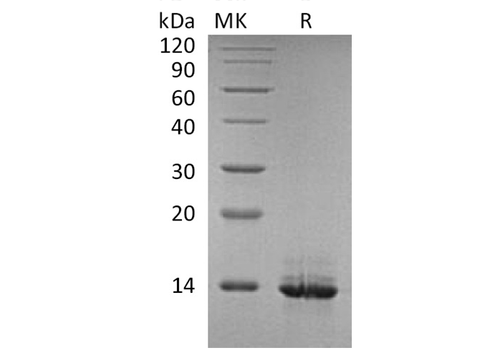 Recombinant Human HMGB1 Protein - ABMIUM