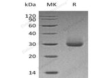 Recombinant Human Kallikrein 4/KLK4 Protein (His Tag) - ABMIUM
