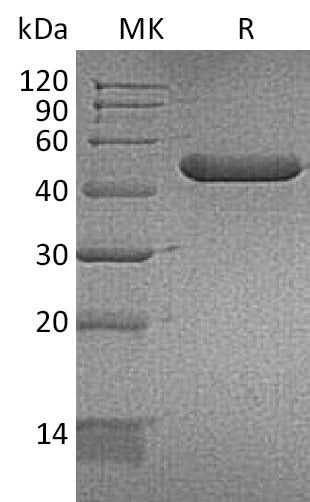 Recombinant Mouse YM1/ECF-L/Chil3 Protein (Pro105Ser)(His Tag) - ABMIUM