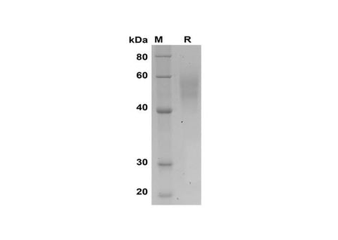 SDS-PAGE analysis of Human AGT proteins, 2 μg/lane of Recombinant Human AGT proteins was resolved with SDS-PAGE under reducing conditions, showing bands at 45-60 kDa.