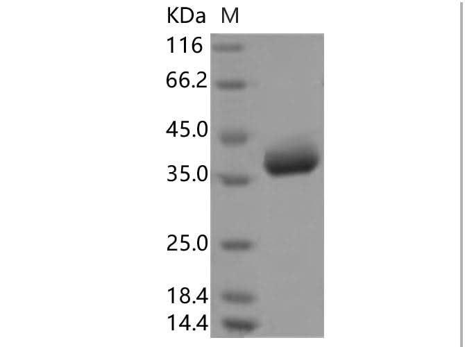 Recombinant SARS-CoV-2 Spike Protein, Biotinylated (RBD, Avi-His Tag) - ABMIUM