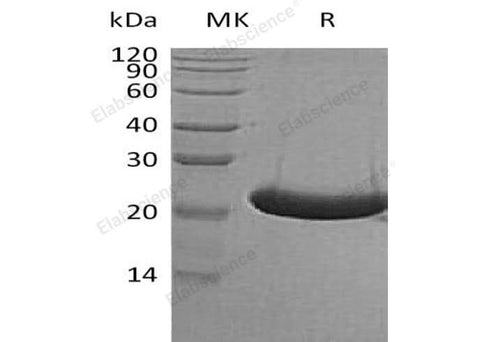 Recombinant Human TREML1/TLT-1 Protein (His Tag) - ABMIUM