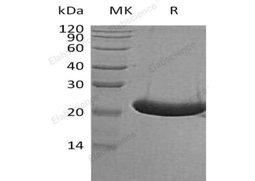 Recombinant Human TREML1/TLT-1 Protein (His Tag) - ABMIUM