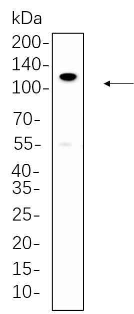 Anti-Human/Mouse/Rat PI3-Kinase p110 β Antibody [B554] - ABMIUM