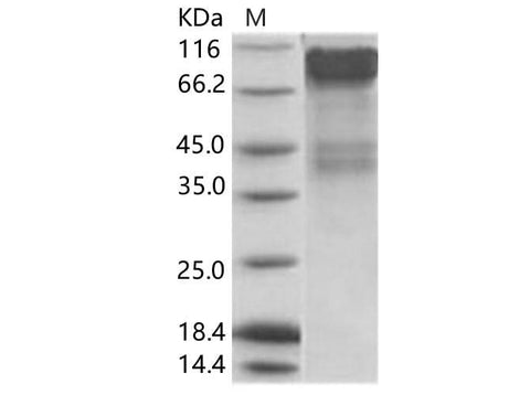 Recombinant EBOV (subtype Bundibugyo, strain Uganda 2007) GP1 / Glycoprotein Protein (His Tag) - ABMIUM