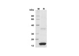SDS-PAGE analysis of Human S100A9 proteins, 2 μg/lane of Recombinant Human S100A9 proteins was resolved with SDS-PAGE under reducing conditions, showing bands at 15 kDa.