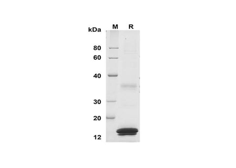 SDS-PAGE analysis of Human S100A9 proteins, 2 μg/lane of Recombinant Human S100A9 proteins was resolved with SDS-PAGE under reducing conditions, showing bands at 15 kDa.