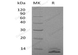 Recombinant Human SSPINK7/ECG2 Protein (His Tag) - ABMIUM