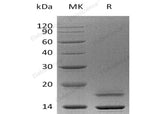 Recombinant Human Cystatin E/CST6 Protein (His Tag) - ABMIUM