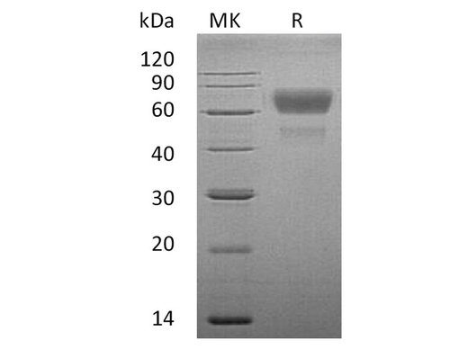 Recombinant Human CD28/TP44 Protein (Fc Tag) - ABMIUM