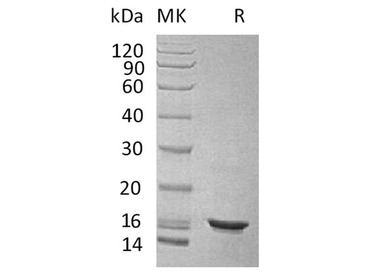Recombinant Human IL-10/Interleukin-10 Protein - ABMIUM