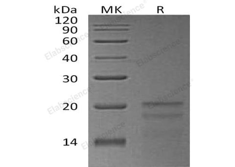 Recombinant Human ZNHIT1 Protein (His Tag) - ABMIUM