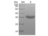 Recombinant Human Kallikrein 7/KLK7 Protein (His Tag) - ABMIUM