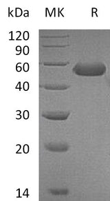 Recombinant Mouse CD5L Protein (His Tag) - ABMIUM