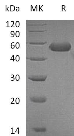 Recombinant Mouse CD5L Protein (His Tag) - ABMIUM