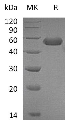 Recombinant Mouse CD5L Protein (His Tag) - ABMIUM