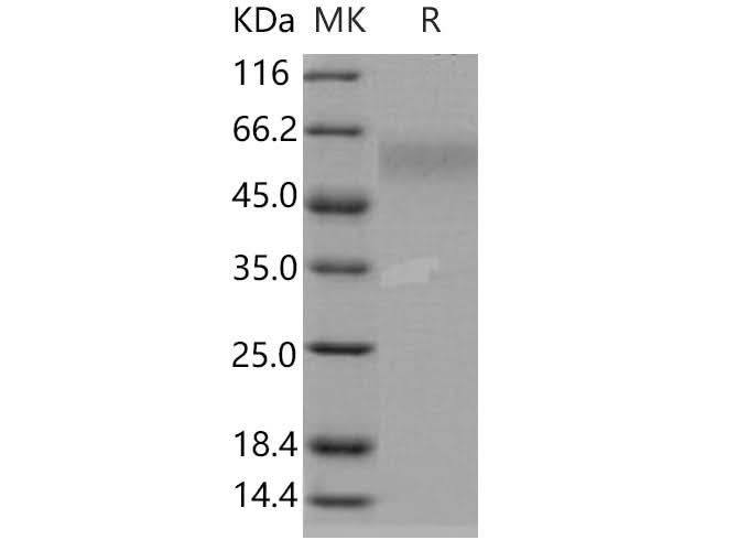 Recombinant Human DR6/TNFRSF21 Protein - ABMIUM