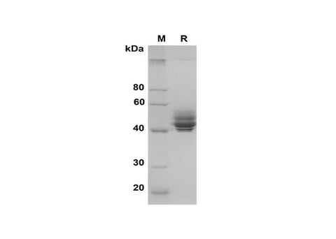 SDS-PAGE analysis of Mouse IL-12B(p40) proteins, 2 μg/lane of Recombinant Mouse IL-12B(p40) proteins was resolved with SDS-PAGE under reducing conditions, showing bands at 40-50 kDa.