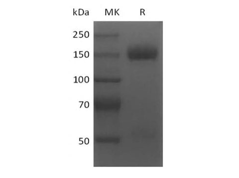 Recombinant Mouse VEGF Receptor 2/VEGF R2/FLK-1/KDR (C-Fc) - ABMIUM