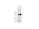 Anti-Human/Mouse/Rat E-Cadherin Antibody - ABMIUM