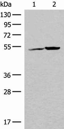 Anti-Human/Mouse FECH Antibody