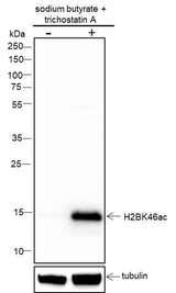 Anti-Human/Rat/Mouse Histone H2B (Acetyl Lys46) Antibody [A101]