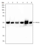 Anti-Human/Rat/Mouse PPP1CB Antibody [A337]