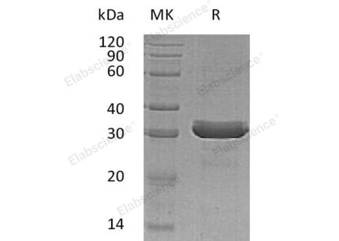 Recombinant Human HDGFRP3/HDGFL3 Protein (His Tag) - ABMIUM