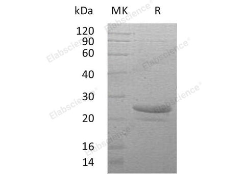 Recombinant Human Cardiotrophin-1/CTF1 Protein (His Tag) - ABMIUM