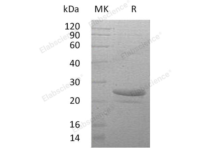 Recombinant Human Cardiotrophin-1/CTF1 Protein (His Tag) - ABMIUM