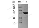 Recombinant Human Ketohexokinase/KHK Protein (His Tag) - ABMIUM