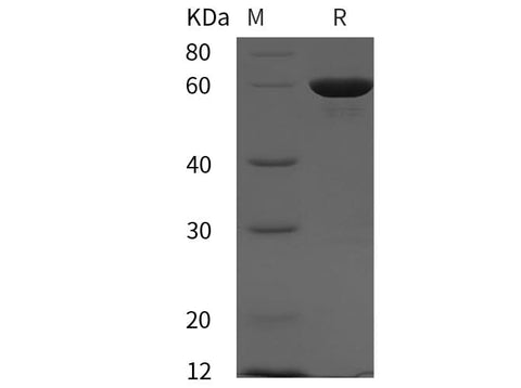 SDS-PAGE analysis of Human PTPN11 proteins, 2 μg/lane of Recombinant Human PTPN11 proteins was resolved with SDS-PAGE under reducing conditions, showing bands at 60 kDa.