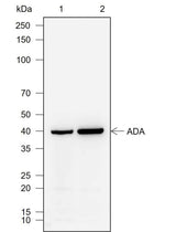 Anti-Human ADA Antibody [A757]