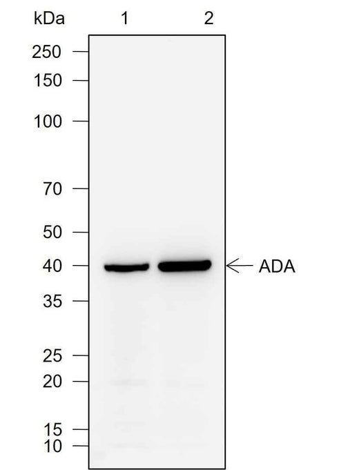 Anti-Human ADA Antibody [A757] - ABMIUM