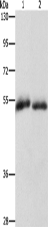Anti-Human CD36 Antibody - ABMIUM