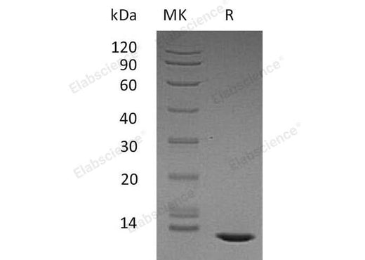 Recombinant Human TGFB2 Protein - ABMIUM