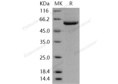 Recombinant Human STK4/MST1 Protein (His Tag) - ABMIUM