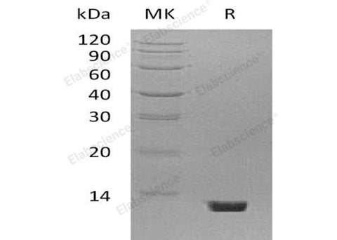 Recombinant Mouse Complement Component C5/C5 Protein - ABMIUM