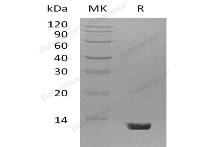 Recombinant Mouse Complement Component C5/C5 Protein - ABMIUM