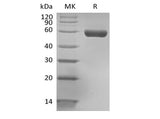 Recombinant Human HLA-A*0201 GP100 complex Protein (C-Avi-10His) Biotinylated - ABMIUM